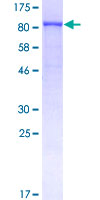 12.5% SDS-PAGE Stained with Coomassie Blue.